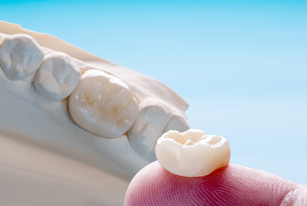 What Are Early Childhood Caries? Causes & Prevention