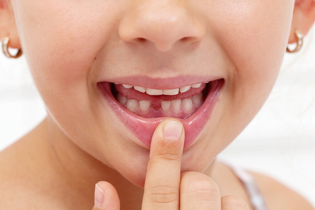 Why Is My Child's Tooth Not Growing Back?